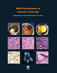 Who Classification of Tumours of the Eye (World Health Organization Classification of Tumours)