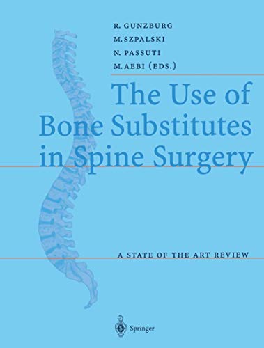 The Use of Bone Substitutes in Spine Surgery: A State of the Art Review