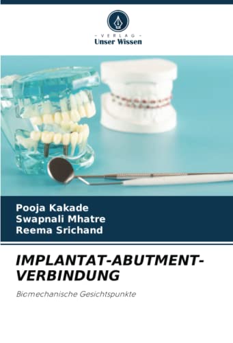 IMPLANTAT-ABUTMENT-VERBINDUNG: Biomechanische Gesichtspunkte