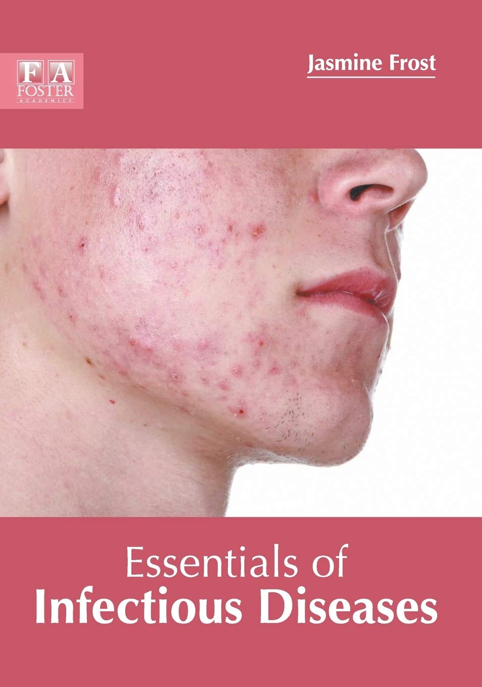 Essentials of Infectious Diseases