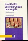 Krankhafte Veränderungen des Nagels