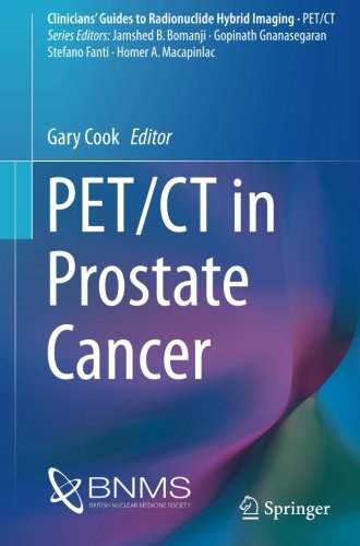 PET/CT in Prostate Cancer (Clinicians' Guides to Radionuclide Hybrid Imaging)