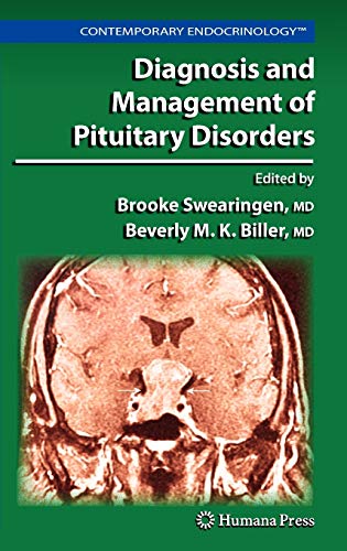 Diagnosis and Management of Pituitary Disorders (Contemporary Endocrinology)