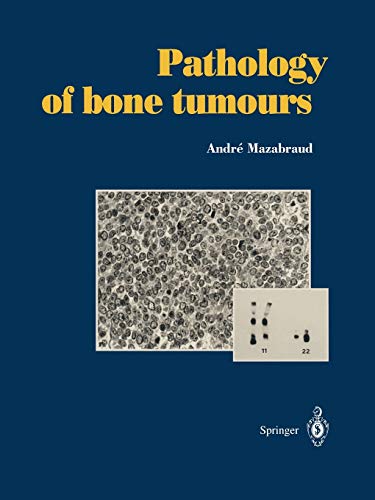 Pathology of bone tumours: Personal experience
