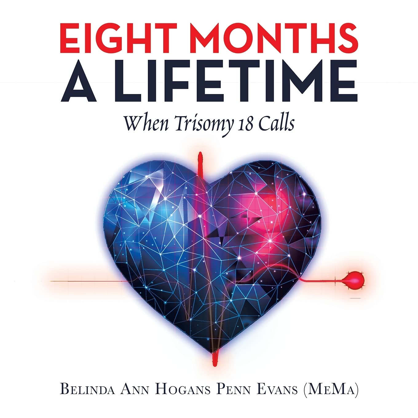Eight Months a Lifetime: When Trisomy 18 Calls