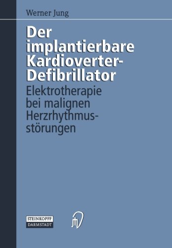 Der implantierbare Kardioverter-Defibrillator