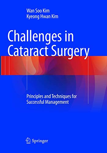 Challenges in Cataract Surgery: Principles and Techniques for Successful Management
