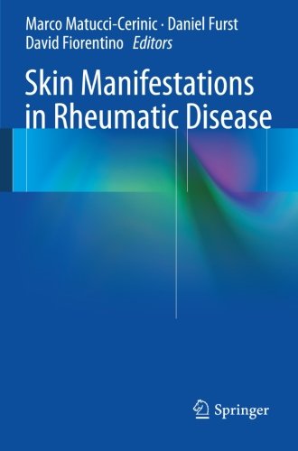 Skin Manifestations in Rheumatic Disease