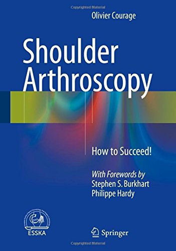 Shoulder Arthroscopy: How to Succeed!