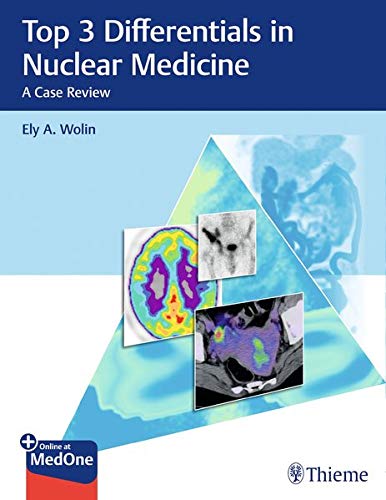 Top 3 Differentials in Nuclear Medicine: A Case Review