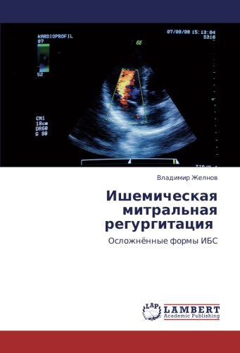 Ишемическая митральная регургитация: Осложнённые формы ИБС: Oslozhnönnye formy IBS