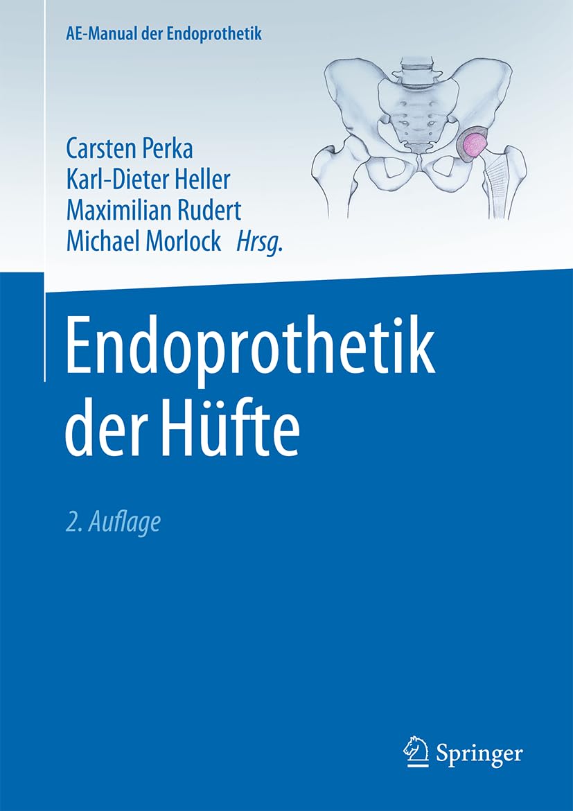 Endoprothetik der Hüfte (AE-Manual der Endoprothetik)
