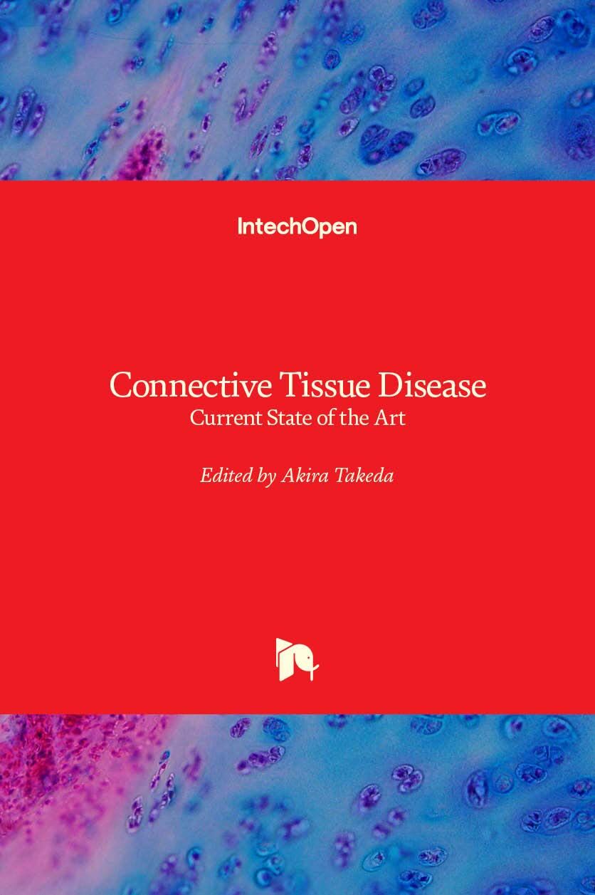 Connective Tissue Disease