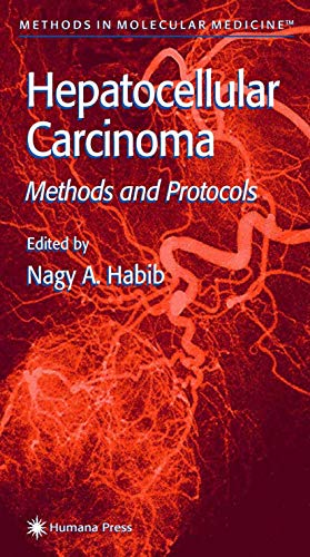 Hepatocellular Carcinoma: Methods and Protocols (Methods in Molecular Medicine) (Methods in Molecular Medicine, 45, Band 45)