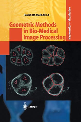 Geometric Methods in Bio-Medical Image Processing (Mathematics and Visualization)