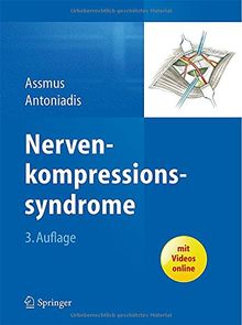 Nervenkompressionssyndrome