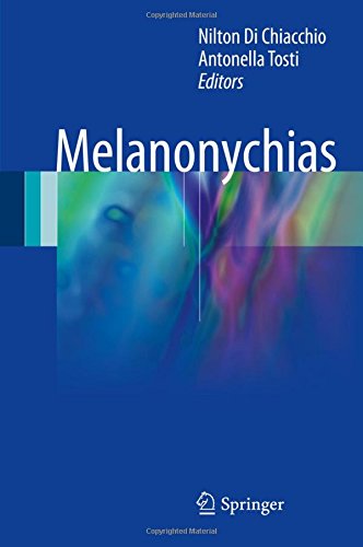 Melanonychias