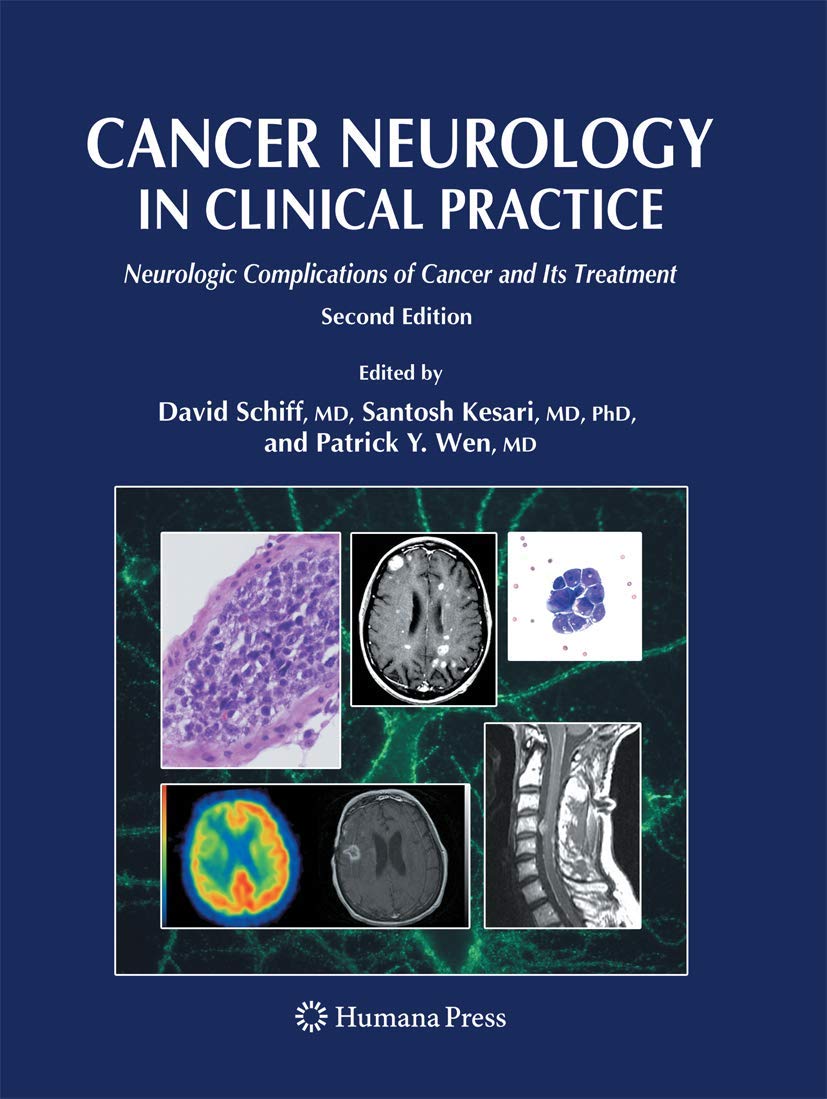 Cancer Neurology in Clinical Practice: Neurologic Complications of Cancer and Its Treatment