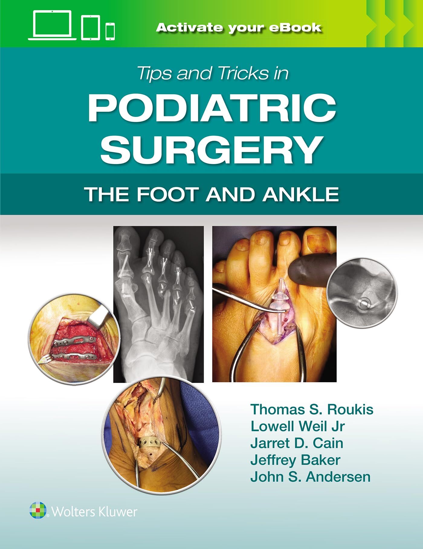Tips and Tricks in Podiatric Surgery: The Foot and Ankle: Print + eBook with Multimedia - Neuware