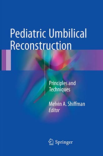 Pediatric Umbilical Reconstruction: Principles and Techniques