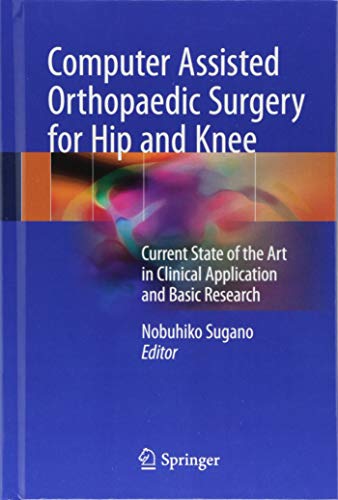 Computer Assisted Orthopaedic Surgery for Hip and Knee: Current State of the Art in Clinical Application and Basic Research