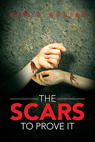 The Scars to Prove it
