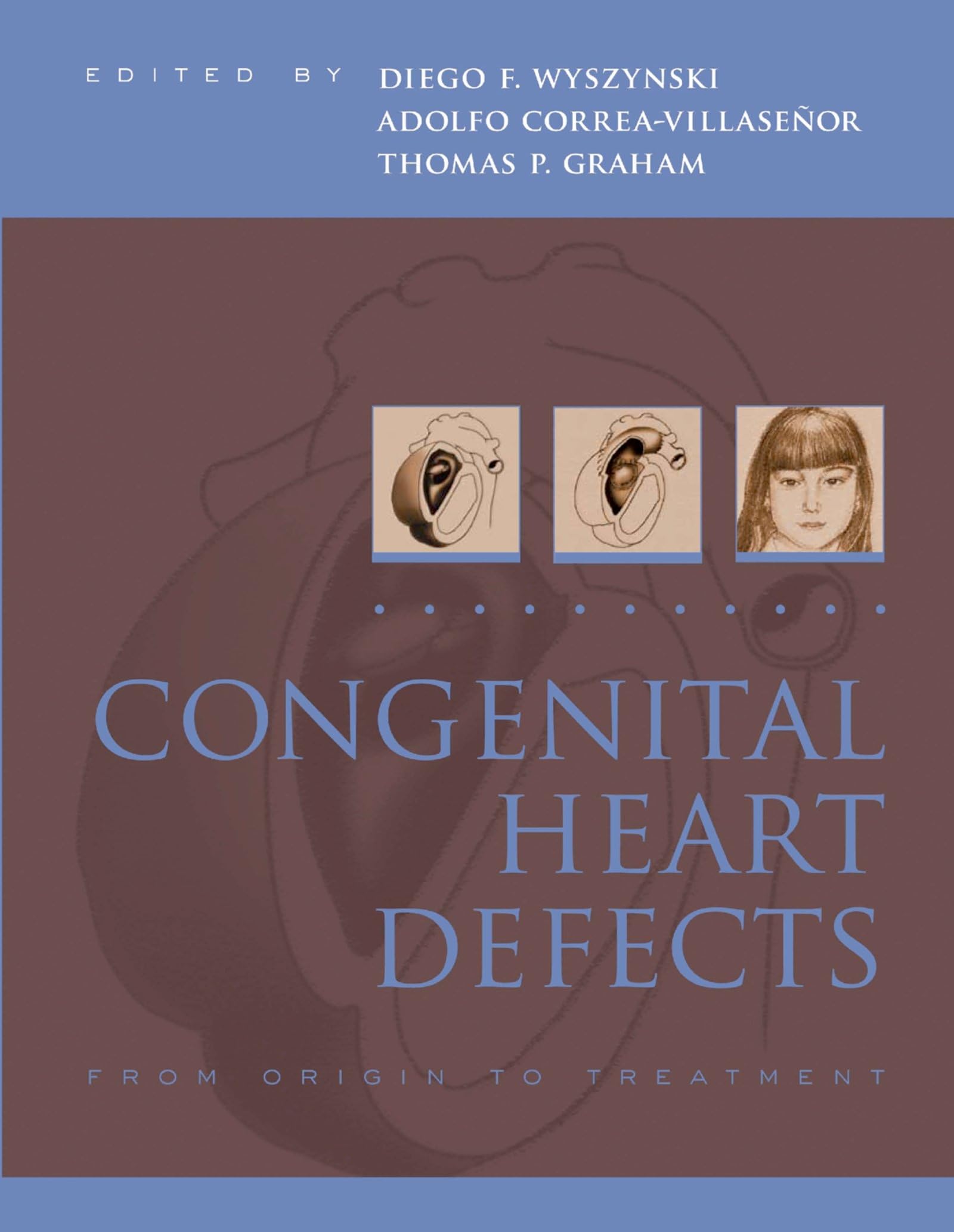 Congenital Heart Defects: From Origin to Treatment
