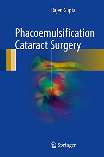 Phacoemulsification Cataract Surgery - Rajen Gupta Gebunden
