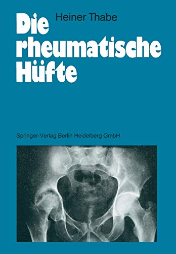 Die rheumatische Hüfte (German Edition)