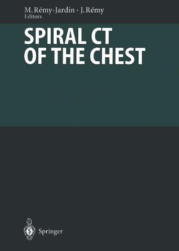 Spiral CT of the Chest (Medical Radiology)