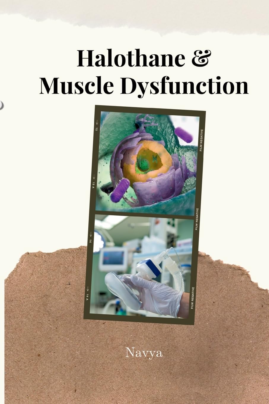 Halothane & Muscle Dysfunction: DE