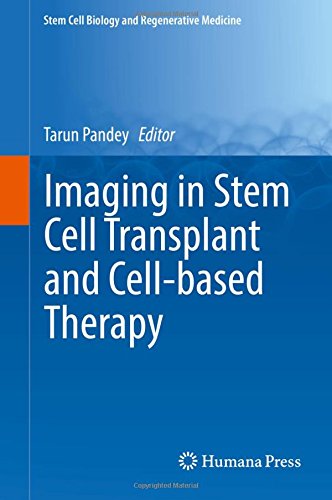 Imaging in Stem Cell Transplant and Cell-based Therapy (Stem Cell Biology and Regenerative Medicine)