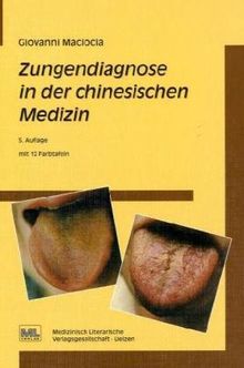 Zungendiagnose in der chinesischen Medizin