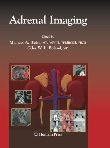 Adrenal Imaging (Contemporary Medical Imaging)