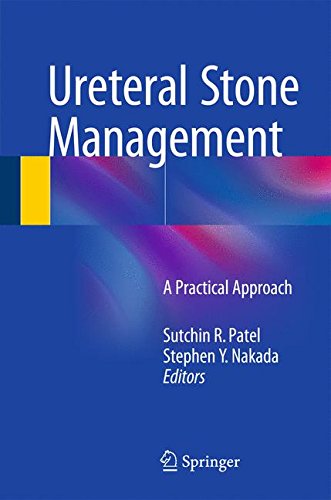 Ureteral Stone Management: A Practical Approach