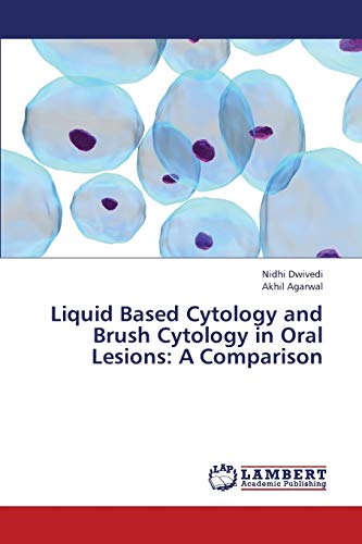Liquid Based Cytology and Brush Cytology in Oral Lesions: A Comparison