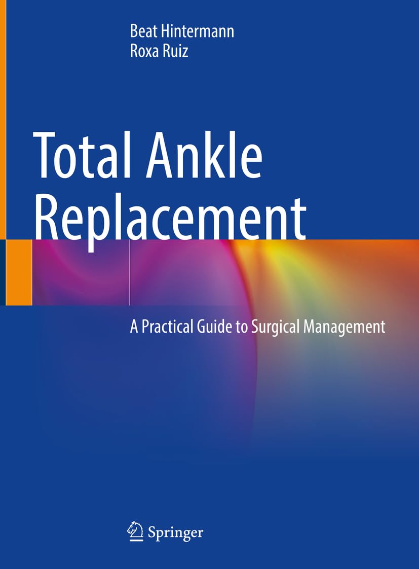 Total Ankle Replacement: A Practical Guide to Surgical Management