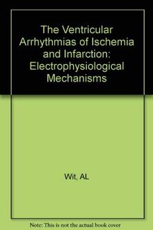 The Ventricular Arrhythmias of Ischemia and Infarction: Electrophysiological Mechanisms