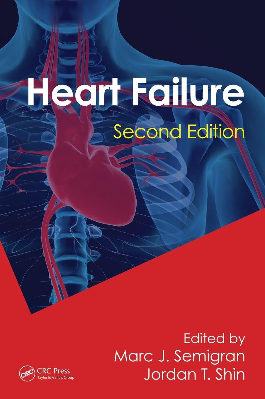 Heart Failure (Fundamental and Clinical Cardiology)