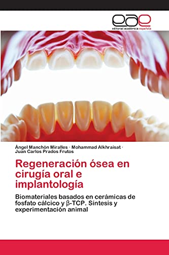 Regeneración ósea en cirugía oral e implantología: Biomateriales basados en cerámicas de fosfato cálcico y β-TCP. Síntesis y experimentación animal: ... y ¿-TCP. Síntesis y experimentación animal