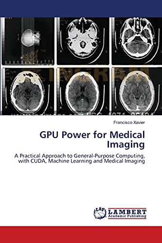 GPU Power for Medical Imaging: A Practical Approach to General-Purpose Computing, with CUDA, Machine Learning and Medical Imaging