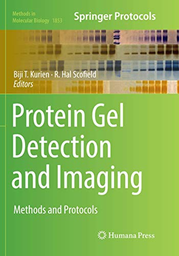 Protein Gel Detection and Imaging: Methods and Protocols (Methods in Molecular Biology, Band 1853)