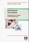 Gynäkologische Tumorzytologie. Zytodiagnostik nach Strahlen- und Zytostatikatherapie