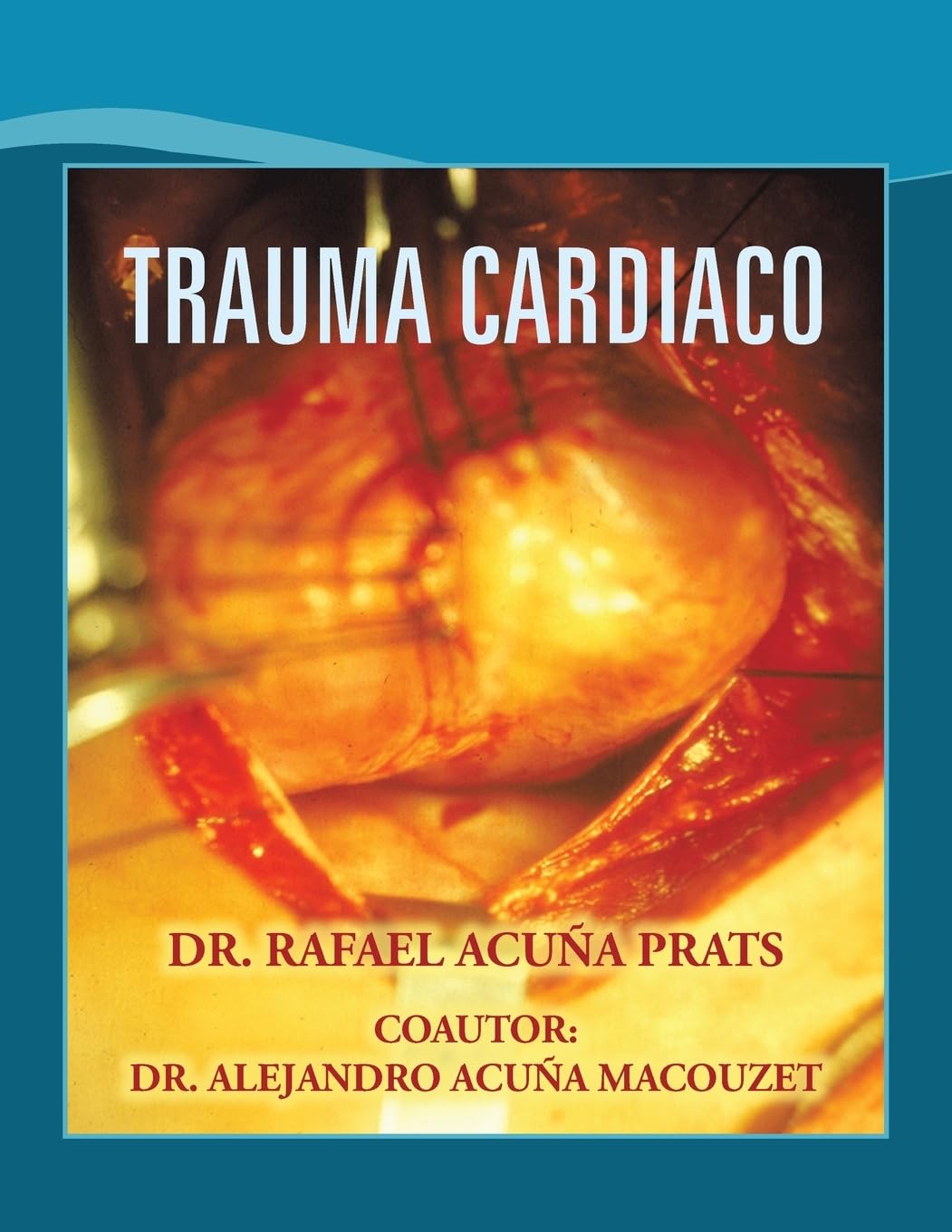 TRAUMA CARDIACO