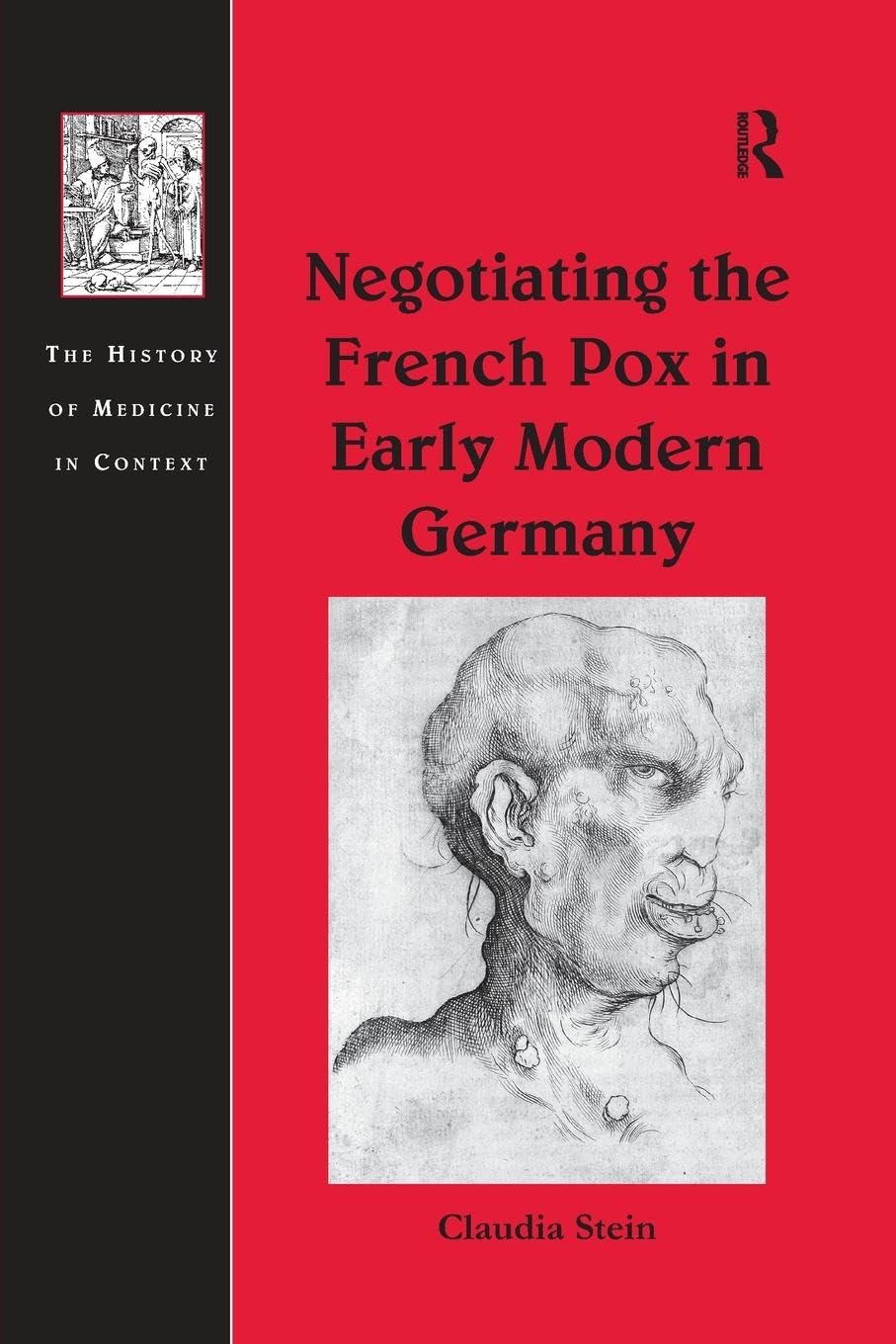 Negotiating the French Pox in Early Modern Germany (History of Medicine in Context)