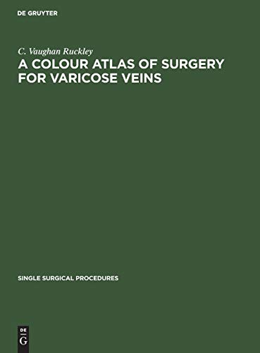 A Colour Atlas of Surgery for Varicose Veins (Single surgical procedures, 8, Band 8)