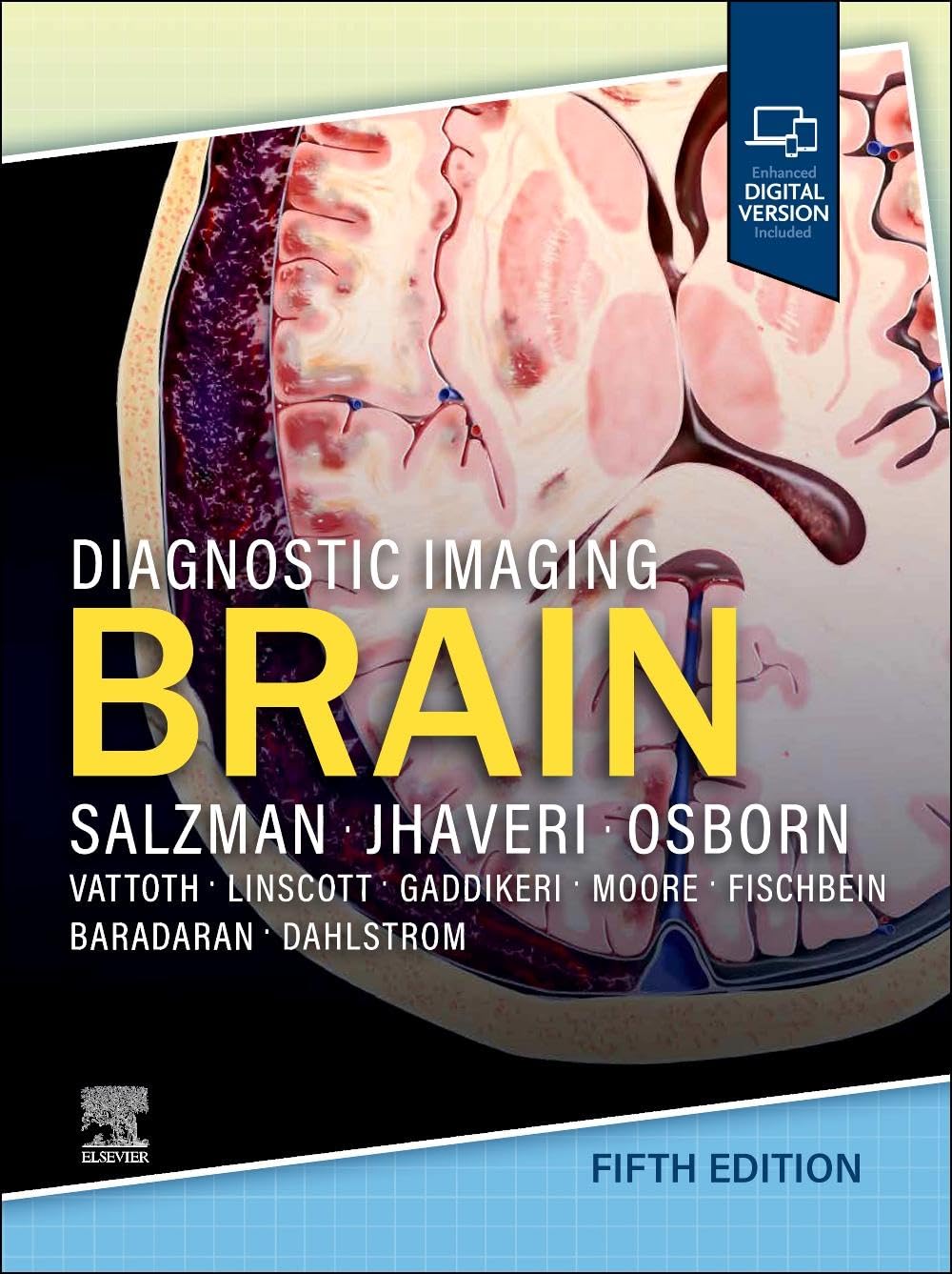 Jhaveri Md Mba, Miral D. Diagnostic Imaging, Brain
