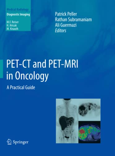 PET-CT and PET-MRI in Oncology: A Practical Guide (Medical Radiology)