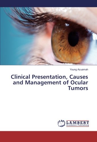 Clinical Presentation, Causes and Management of Ocular Tumors