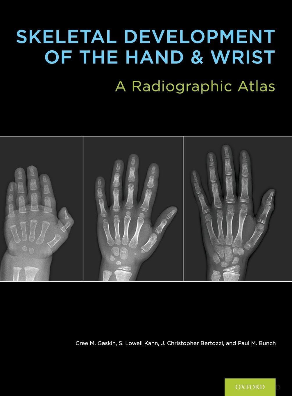 SKEL DEVELOP HAND & WRIST BK & DVD PCK: A Radiographic Atlas and Digital Bone Age Companion